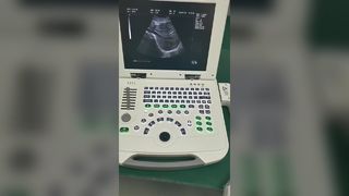 Полностью цифровой портативный ультразвуковой диагностический комплекс 80element BR-US11
