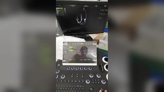 Тележка для цветной доплеровской ультразвуковой диагностики BR-US01