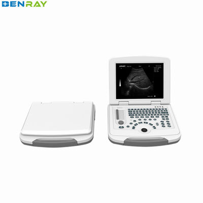 Full-digital laptop Ultrasound Diagnostic System 80element